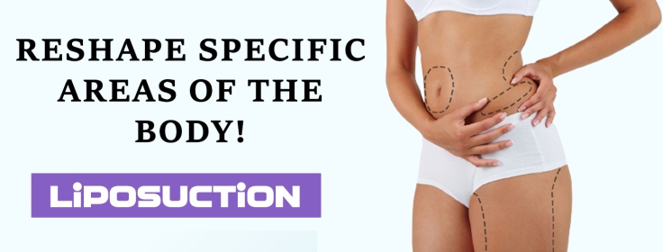 Why You Should Get Liposuction Surgery in Delhi?